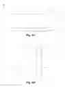 Fig. 10 - Bone fusion device