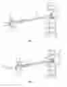 Fig. 07 - Spinal implant system and method