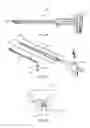 Fig. 21 - Spinal implant system and method