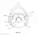 Fig. 28 - Spinal implant system and method