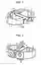 Fig. 02 - Zero profile spinal fusion cage