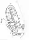 Fig. 04 - Zero profile spinal fusion cage