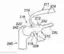 Fig. 01 - Method of installing a percutaneous device