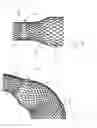 Fig. 04 - COMPRESSIBLE SELF-EXPANDABLE STENT FOR SPLINTING AND/OR KEEPING OPEN A CAVITY, AN ORGAN DUCT, AND/OR A VESSEL IN THE HUMAN OR ANIMAL BODY