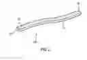 Fig. 04 - Stent
