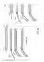 Fig. 06 - Stent