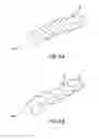 Fig. 07 - Stent