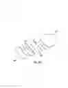 Fig. 20 - Stent