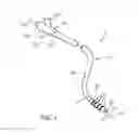 Fig. 02 - Balloon catheters and systems and methods for delivering stents using such catheters