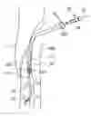 Fig. 01 - SELF-EXPANDABLE STENT DELIVERY SYSTEM