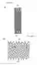 Fig. 05 - SELF-EXPANDABLE STENT DELIVERY SYSTEM