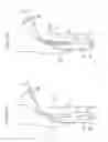 Fig. 07 - SELF-EXPANDABLE STENT DELIVERY SYSTEM