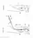 Fig. 10 - SELF-EXPANDABLE STENT DELIVERY SYSTEM