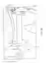 Fig. 07 - PELVIC BINDERS