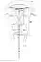 Fig. 01 - Systems and methods for endometrial ablation