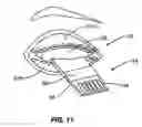 Fig. 10 - Methods and apparatuses for treatment of meibomian gland dysfunction