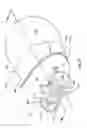 Fig. 28 - Methods and apparatuses for treatment of meibomian gland dysfunction