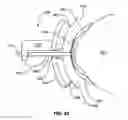 Fig. 29 - Methods and apparatuses for treatment of meibomian gland dysfunction