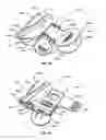 Fig. 33 - Methods and apparatuses for treatment of meibomian gland dysfunction