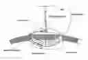 Fig. 01 - TOROIDAL GLAUCOMA DRAINAGE DEVICE