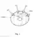 Fig. 02 - TOROIDAL GLAUCOMA DRAINAGE DEVICE