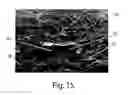 Fig. 11 - Absorbent structure