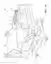 Fig. 03 - Telescoping assembly for use on a patient support apparatus