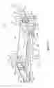 Fig. 20 - Telescoping assembly for use on a patient support apparatus