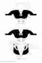 Fig. 06 - Septum that decontaminates by interaction with penetrating element