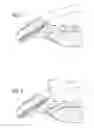 Fig. 02 - Intracameral sustained release therapeutic agent implants