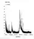Fig. 14 - Method of delivering therapeutics and imaging agents to the brain by nanoparticles that cross the blood brain barrier