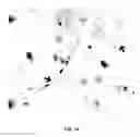 Fig. 20 - Method of delivering therapeutics and imaging agents to the brain by nanoparticles that cross the blood brain barrier