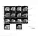 Fig. 19 - Carrier-antibody compositions and methods of making and using the same