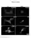 Fig. 08 - METHODS AND PHARMACEUTICAL COMPOSITIONS FOR TREATING DISEASES ASSOCIATED WITH ALTERED SERT ACTIVITY