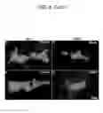 Fig. 10 - METHODS AND PHARMACEUTICAL COMPOSITIONS FOR TREATING DISEASES ASSOCIATED WITH ALTERED SERT ACTIVITY