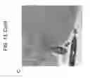 Fig. 22 - METHODS AND PHARMACEUTICAL COMPOSITIONS FOR TREATING DISEASES ASSOCIATED WITH ALTERED SERT ACTIVITY