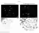 Fig. 08 - Compositions, systems, and methods for generating inner ear hair cells for treatment of hearing loss