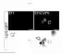 Fig. 13 - Compositions, systems, and methods for generating inner ear hair cells for treatment of hearing loss
