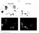 Fig. 22 - Compositions, systems, and methods for generating inner ear hair cells for treatment of hearing loss
