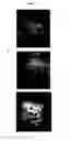 Fig. 04 - Fluorinated integrin antagonists