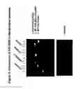 Fig. 05 - MUTANT ROS EXPRESSION IN HUMAN CANCER