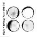 Fig. 08 - MUTANT ROS EXPRESSION IN HUMAN CANCER