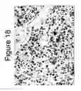 Fig. 20 - MUTANT ROS EXPRESSION IN HUMAN CANCER