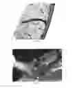 Fig. 08 - Pharmaceutical compositions for treating thermal injuries and wounds combined with bone injuries