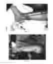 Fig. 09 - Pharmaceutical compositions for treating thermal injuries and wounds combined with bone injuries