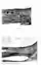 Fig. 04 - Pharmaceutical compositions for treating thermal injuries and wounds combined with bone injuries