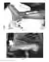 Fig. 09 - Pharmaceutical compositions for treating thermal injuries and wounds combined with bone injuries