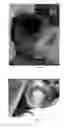 Fig. 10 - Pharmaceutical compositions for treating thermal injuries and wounds combined with bone injuries
