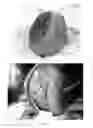 Fig. 16 - Pharmaceutical compositions for treating thermal injuries and wounds combined with bone injuries