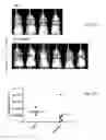Fig. 11 - PEPTIDES THAT BLOCK LEUKOCYTE RECRUITMENT AND METHODS OF USE